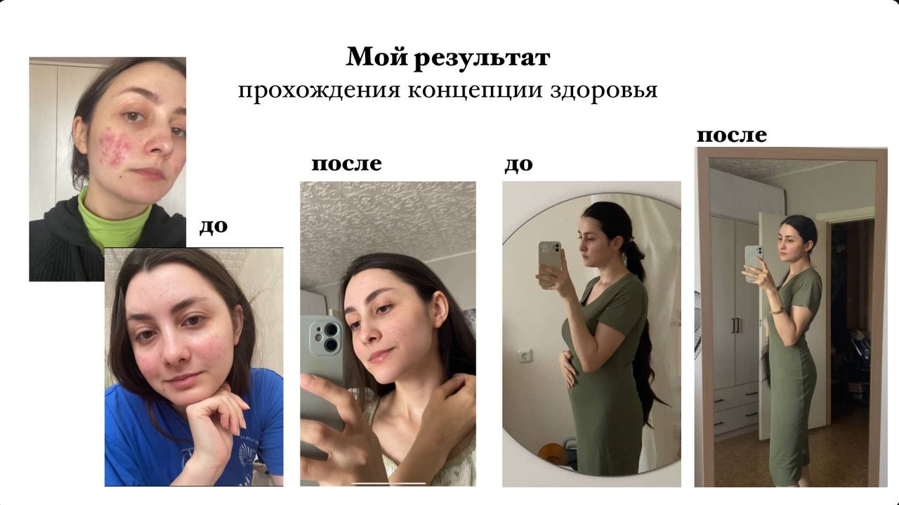 Айнур Щербакова — результат: кожа и фигура до и после за первый месяц